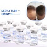 Otesaly Anti Hair Loss Solution - Image 2