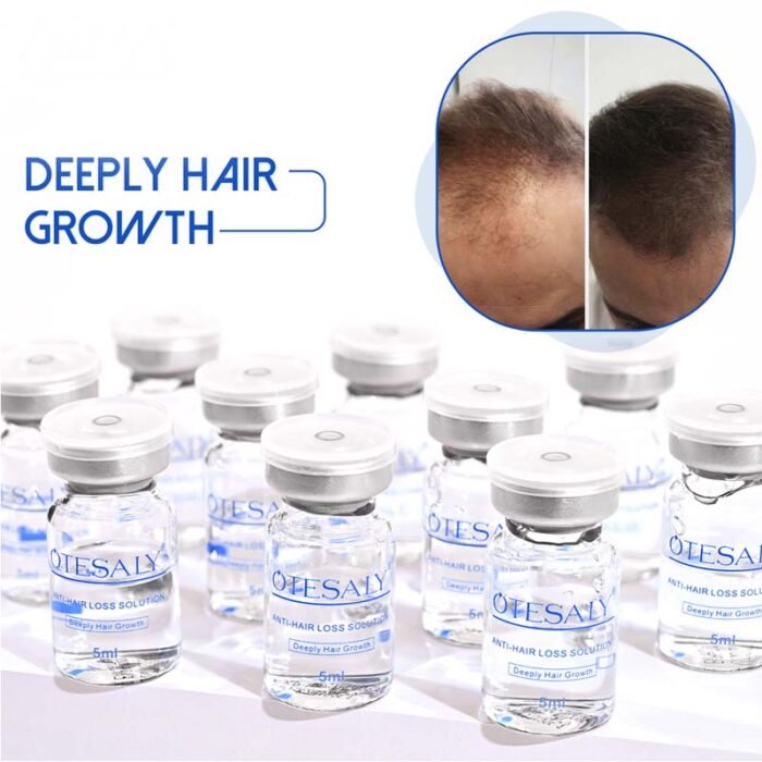 Otesaly Anti Hair Loss Solution - Image 2